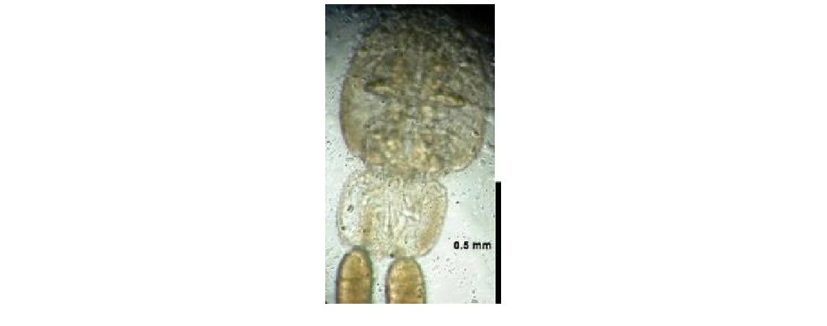 Photomicrograph of the habitus of Anuretes plectorhynchi Yamaguti, 1936 with egg sacs