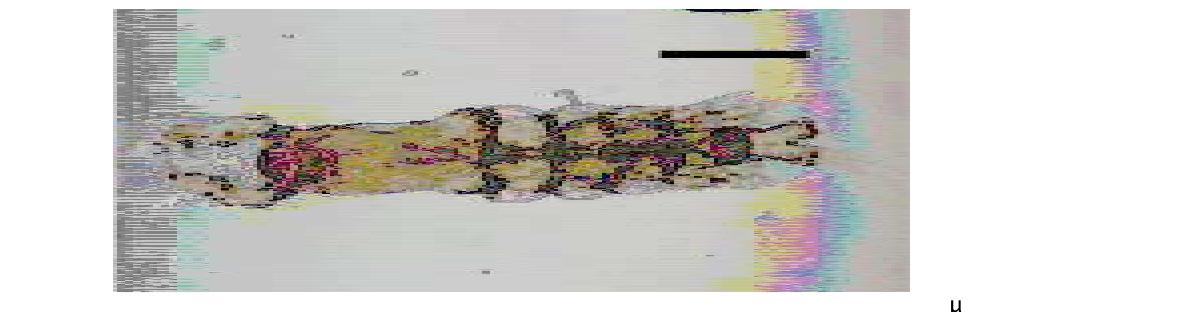 Cymbasoma cf.longispinosum. Male. Habitus, Dorsal. Scale bars: 500 μm