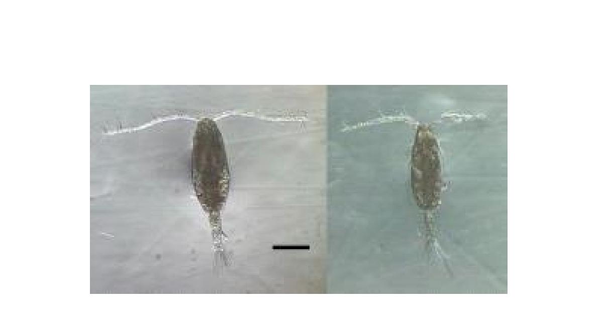 Acartia cf.clausi. Left. Female. Habitus Dorsal; Right. Male. Habitus, Dorsal. Scale bars: 300 μm