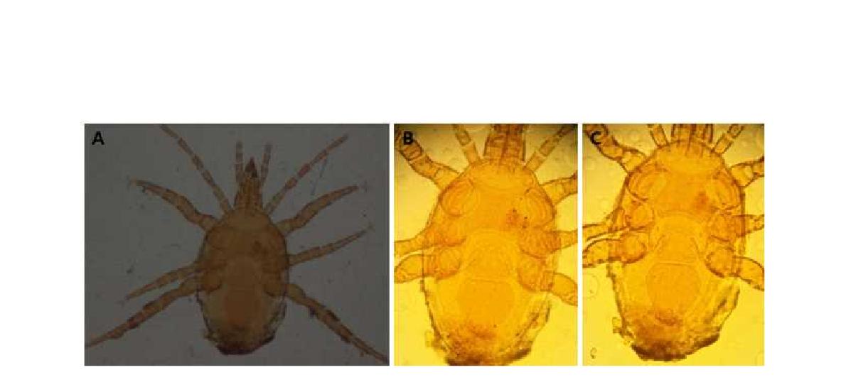 (A) Microscopic image of Macrocheles japonicus Evans and Hyatt, 1963; (B) Dorsal view; (C) Ventral view.