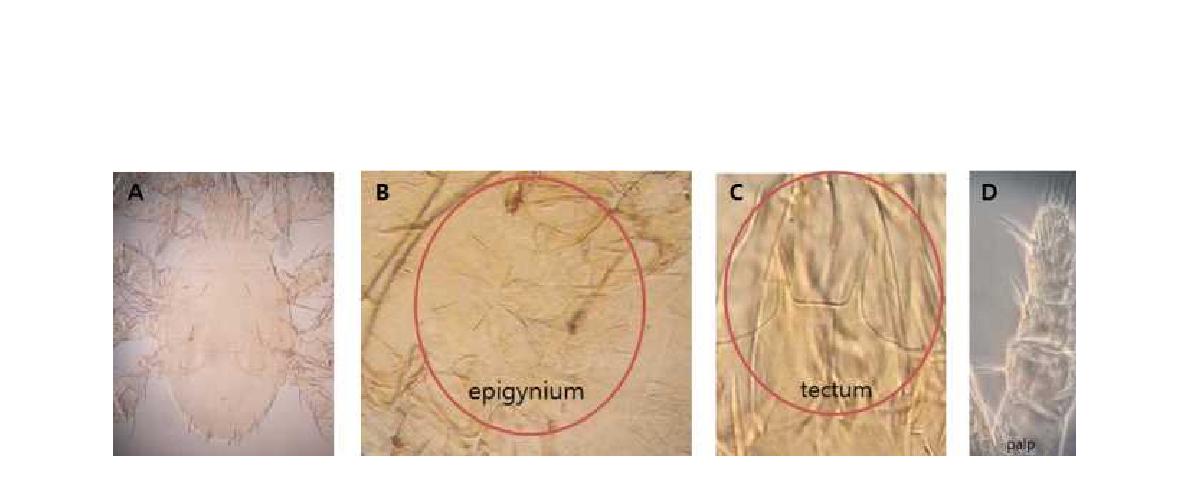 (A) Microscopic image of Parasitus beta Oudemans  (B) Epigynium; (C) Tectum; (D) Palp.