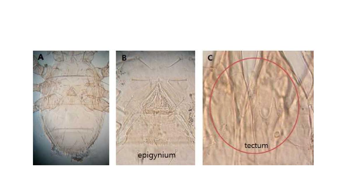 (A) Microscopic image of Parasitus fimetorum Berlese, 1904; (B) Epigynium; (C) Tectum.