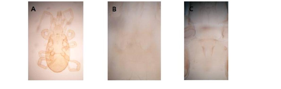 (A) Microscopic image of Neogamasus kengicus Athias-Henriot, 1977; (B) Tectum; (C) Pretasternal shield.