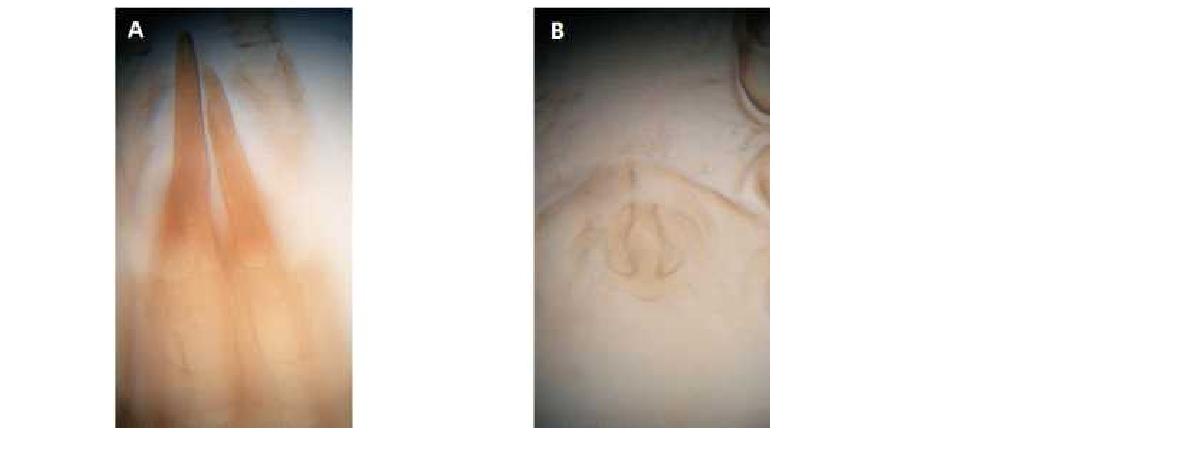 (A) Tectum of Neogamasus kengicus Athias-Henriot, 1977; (B) Epigynum .