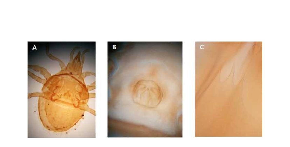 (A) Microscopic image of Cycetogamasus coreanus Athias-Henriot, 1980; (B) Epigyum; (C) Tectum.