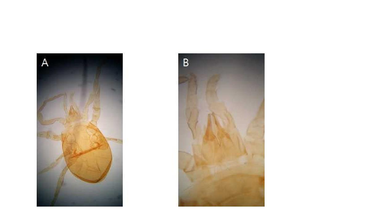 (A) Microscopic image of Cycetogamasus corculatus Athias-Henriot, 1980; (B) Chelicera.