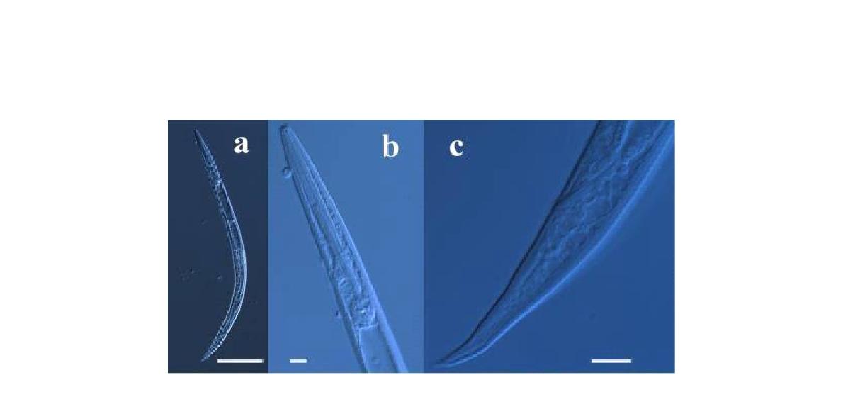 Pseudacrobeles n. sp. a. entire body. 100X. scale bar 100㎛; b. head and esophagus region. 400X. scale bar 10㎛; c. tail region. 1000X. scale bar 10 ㎛