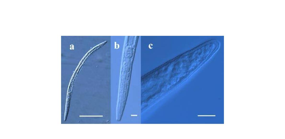 Acrobeloides nanus a. entire body. 100X. scale bar 100㎛; b. head and esophagus region. 400X. scale bar 10㎛; c. tail region. 1000X. scale bar 10 ㎛