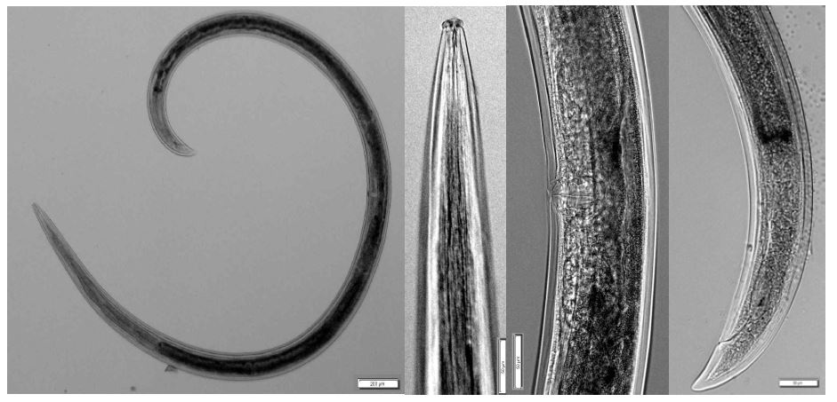 Aporcelaimus superbus (de Man, 1880) Goodey, 1951. Overall view; Anterior part; Vulva; Posterior part of female. Bar represents ㎛.