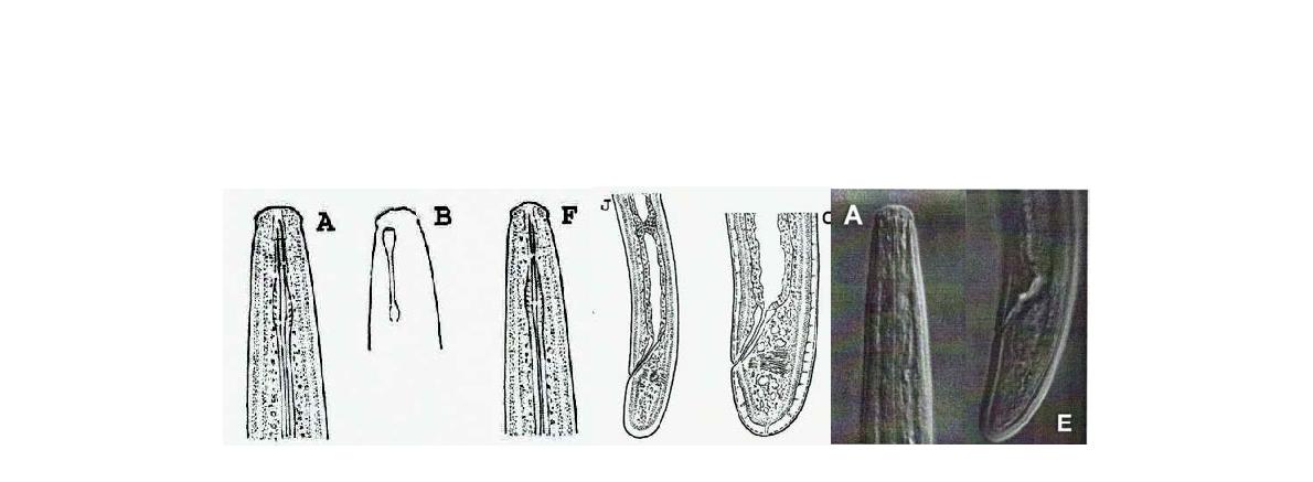 Tylencholaimus intermedius Peña-Santiago and Coomans, 1996 Overall view; Anterior part; Vulva; Posterior part of female. Bar represents ㎛.