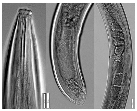 Aporcelaimellus obtusicaudatus (Bastian, 1865) Altherr, 1968. Overall view; Anterior part; Vulva; Posterior part of female. Bar represents ㎛.