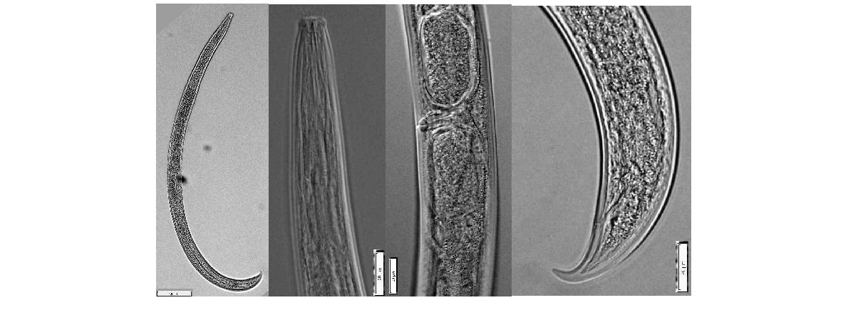 Eudorylaimus arcus (Thorne and Swanger, 1936) Andrassy, 1959. Overall view; Anterior part; Vulva; Posterior part of female. Bar represents ㎛.