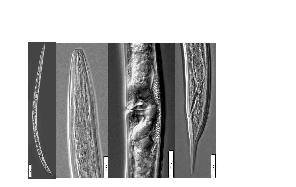 Mesodorylaimus spengelii (de Man 1912) Andrassy, 1959. Overall view; Anterior part; Vulva; Posterior part of female. Bar represents ㎛.