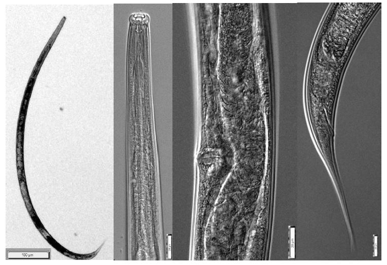 Trachypleurosum conforme (Schneider, 1935) Andrássy, 1959. Overall view; Anterior part; Vulva; Posterior part of female. Bar represents ㎛.