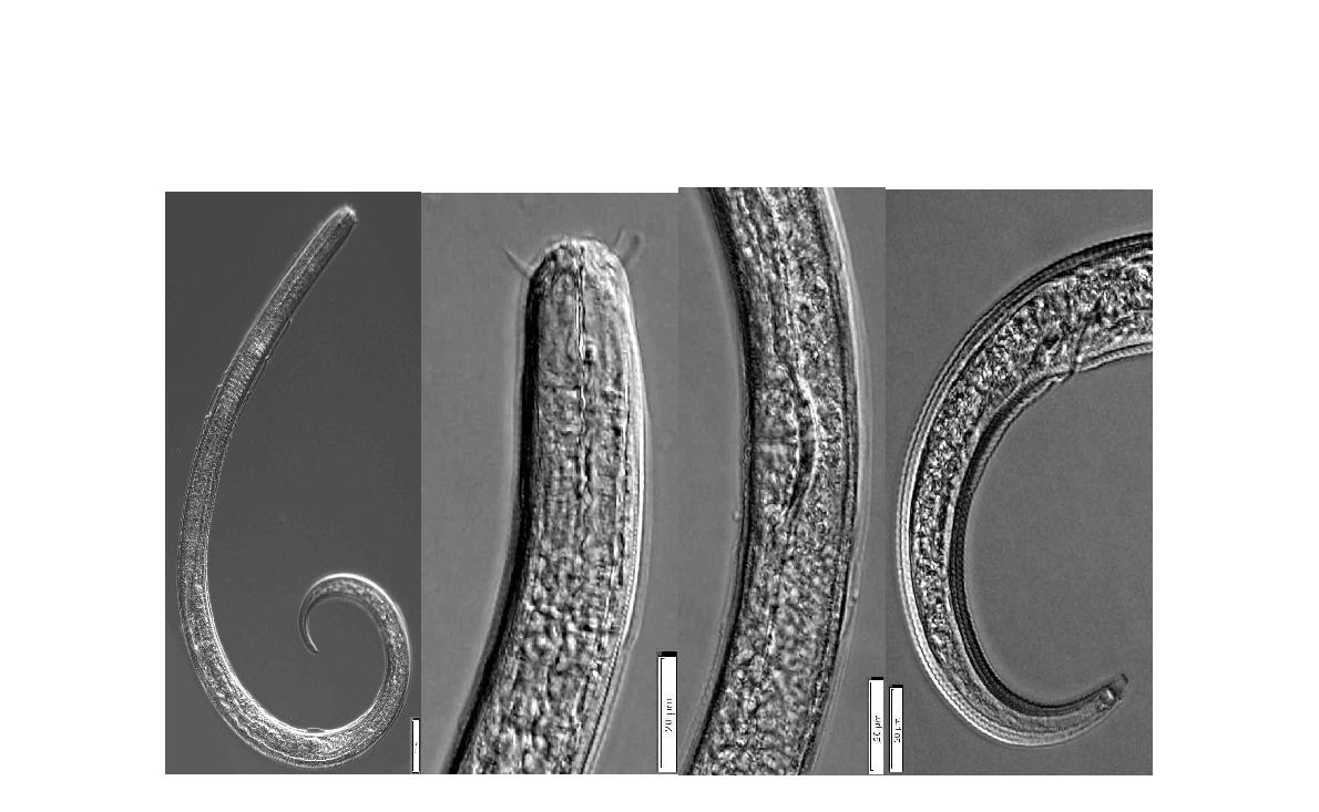 Tripyla terricola Brzeski  Anterior part; Vulva; Posterior part of female. Bar represents ㎛.