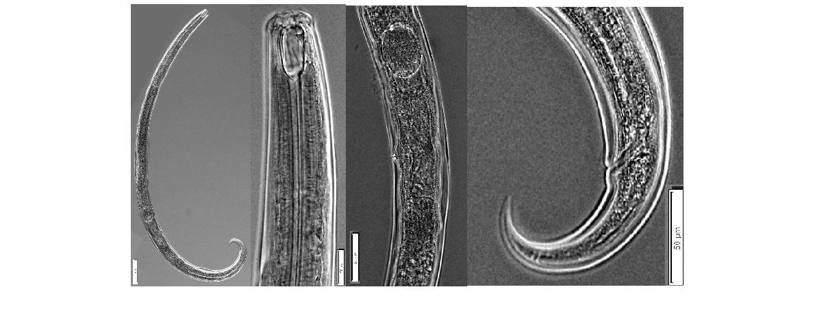 Prionchulus mordax Andrassy 1993. Overall view; Anterior part; Vulva; Posterior part of female. Bar represents ㎛.