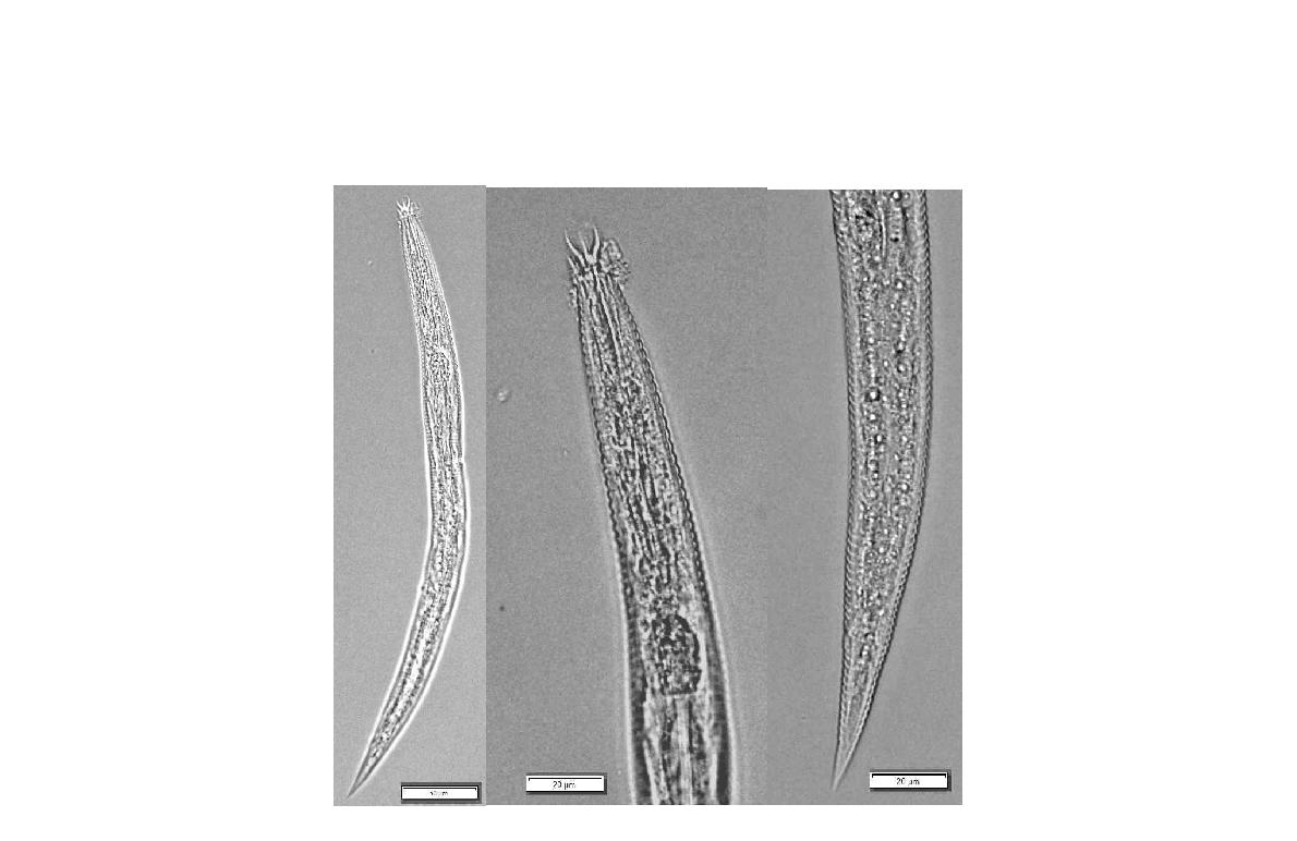 Acrobeles ciliatus von Linstow, 1877. Overall view; Anterior part; Vulva; Posterior part of female. Bar represents ㎛.