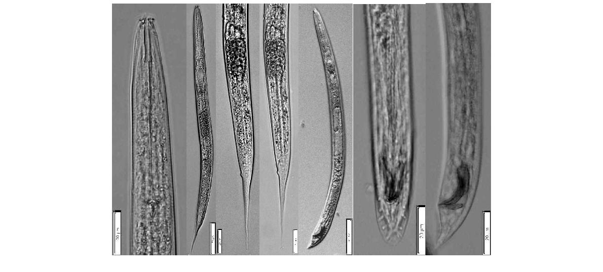 Diploscapter coronatus (Cobb, 1893) Cobb, 1913. Anterior part; Overall view of female; Posterior part of female; Overall view of male; Posterior part of male; Bar represents ㎛.