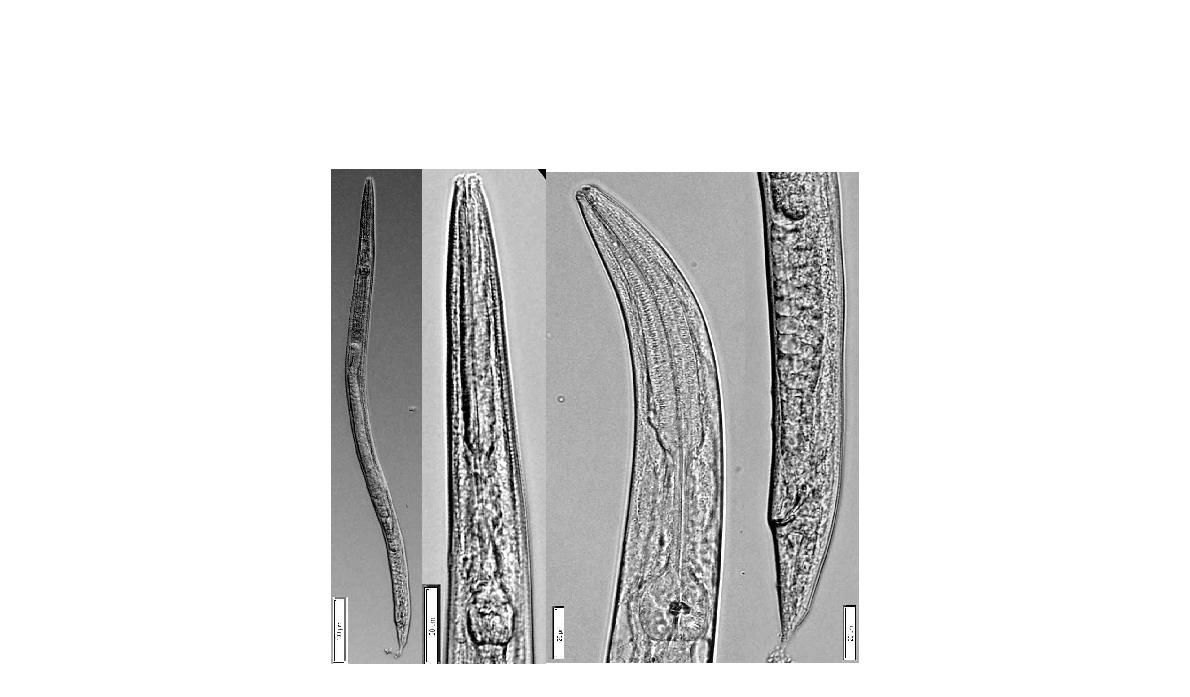 Panagrolaimus apicatus Schuurmans Stekhoven  Anterior part; Vulva; Posterior part of female. Bar represents ㎛.