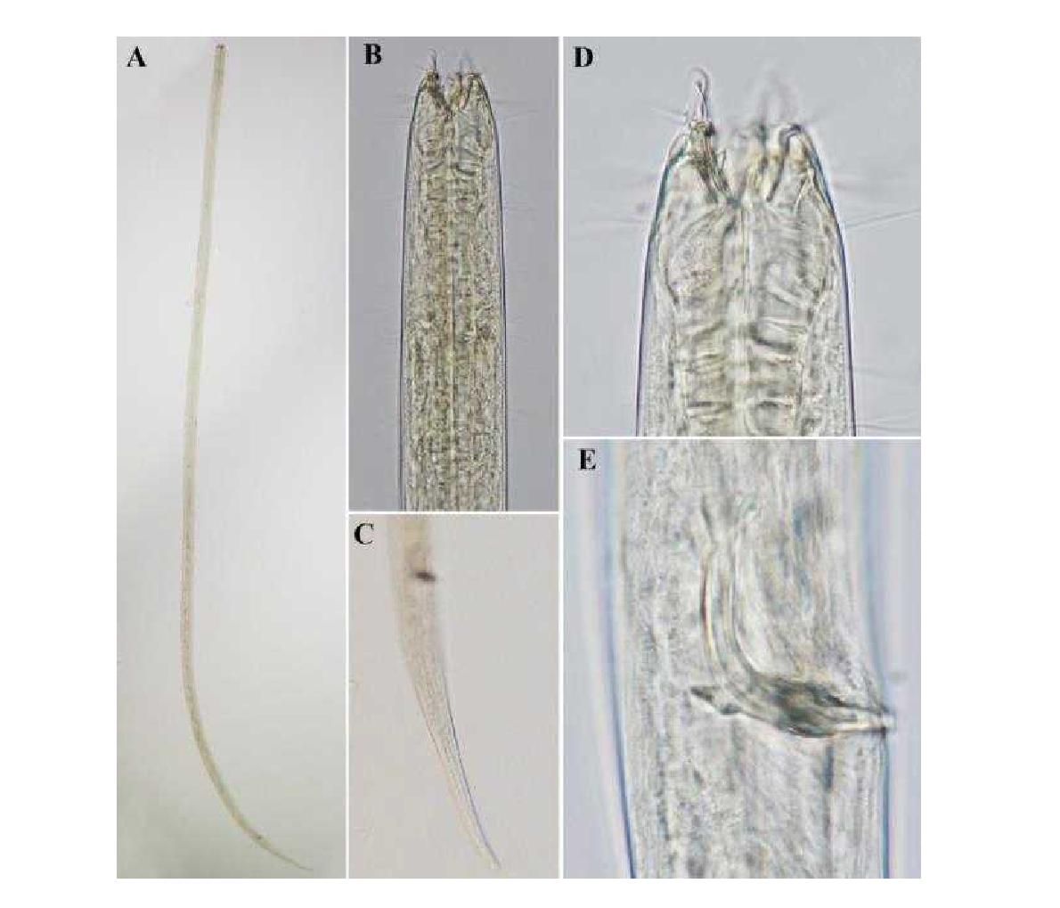 Enoplolaimus litoralis DIC photomicrographs, lateral view.