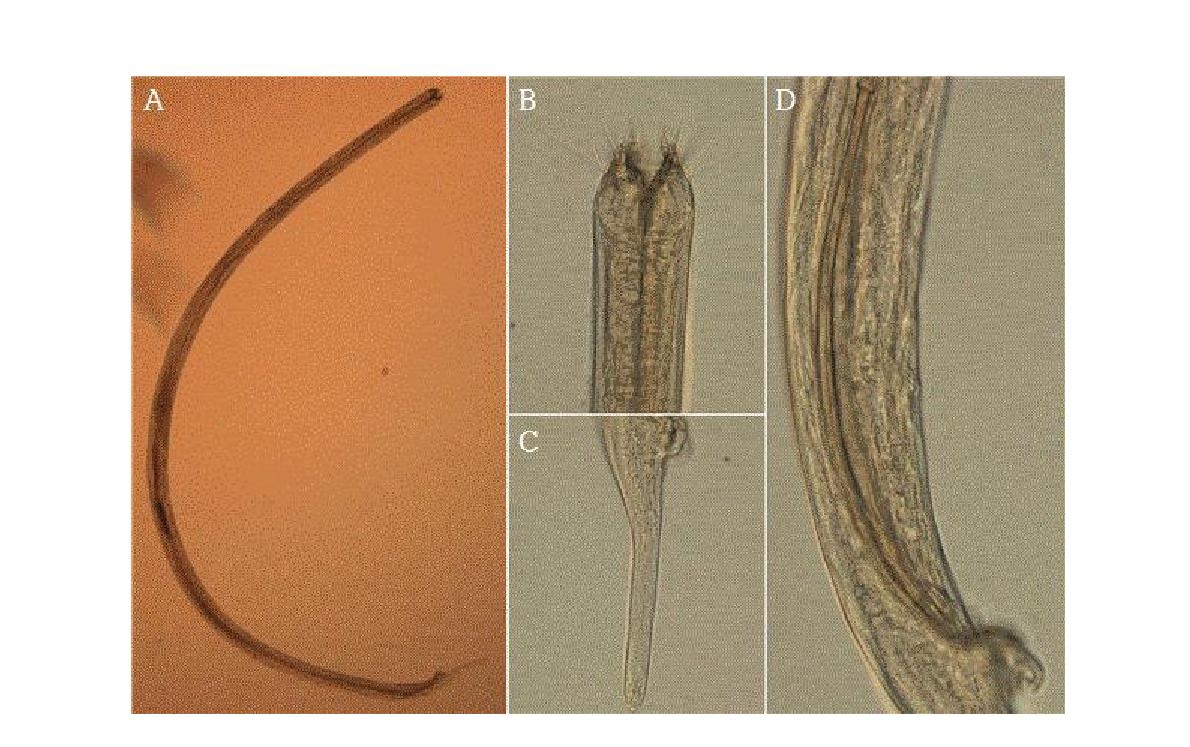 Enoploides brunettii DIC photomicrographs, lateral view.