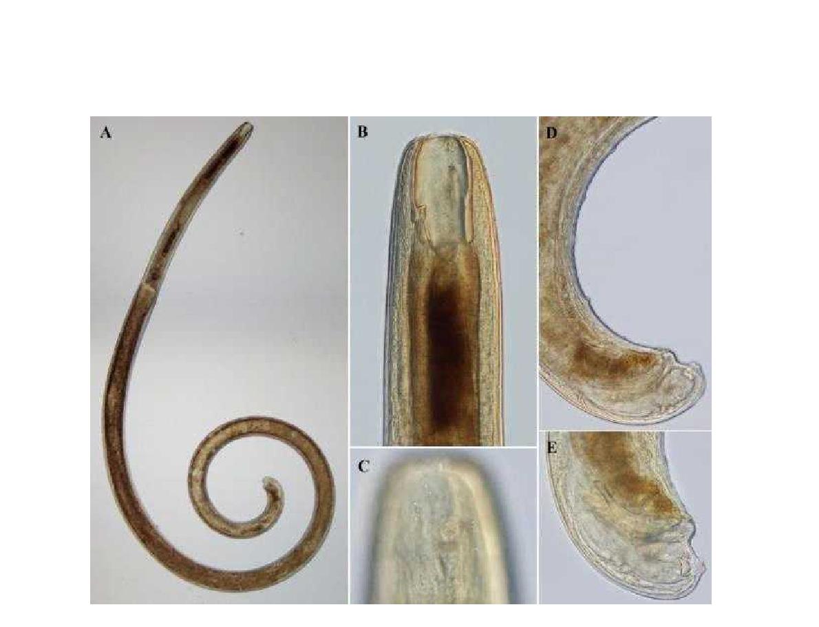 Pontonema papiliferum DIC photomicrographs, lateral view.