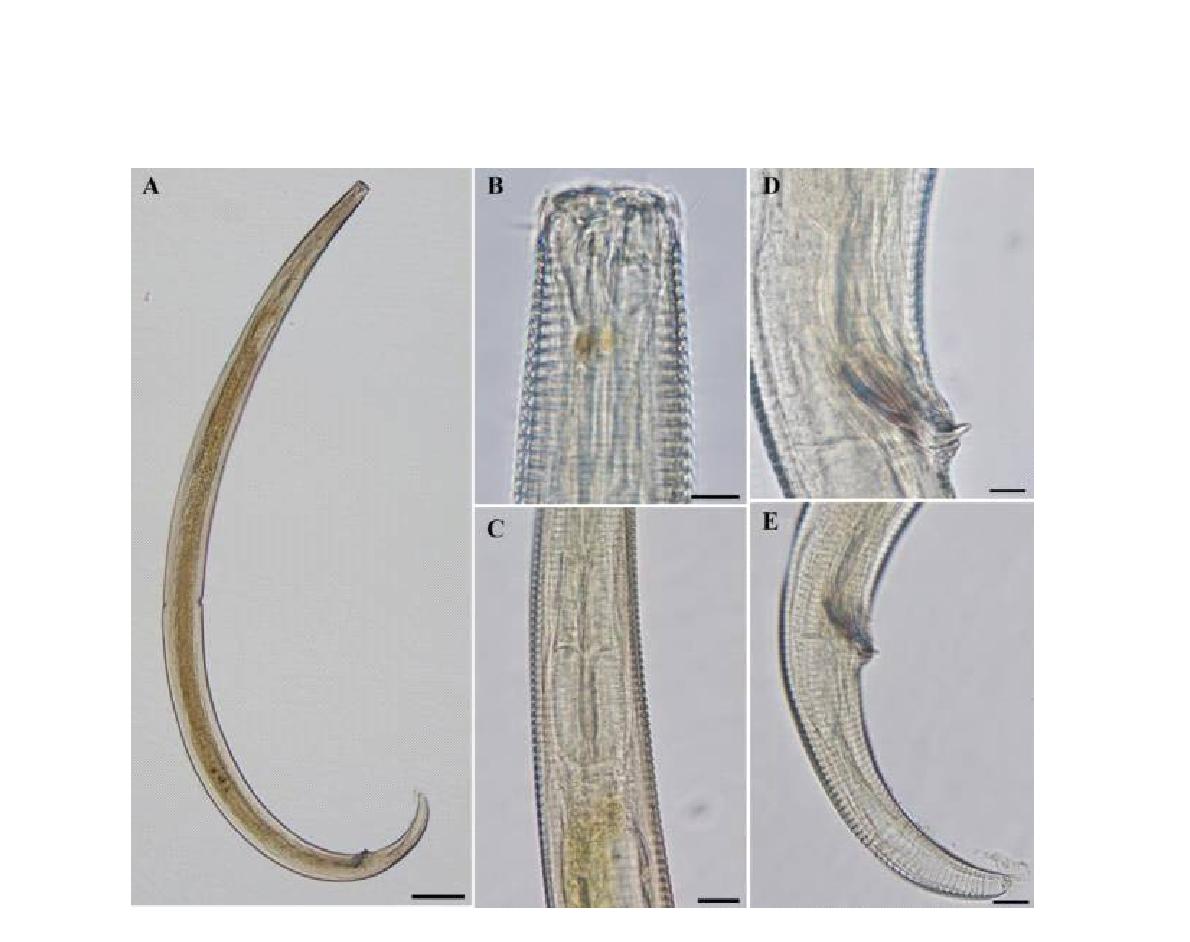 Steineridora borealis DIC photomicrographs, lateral view.