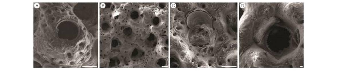 Rhynchozoon n. sp. A orifice B, suboral and frontal avicularia C, ovicell and suboral avicularium; D, ovicell and mucrones. Scale bars = 100 ㎛ (A-D).