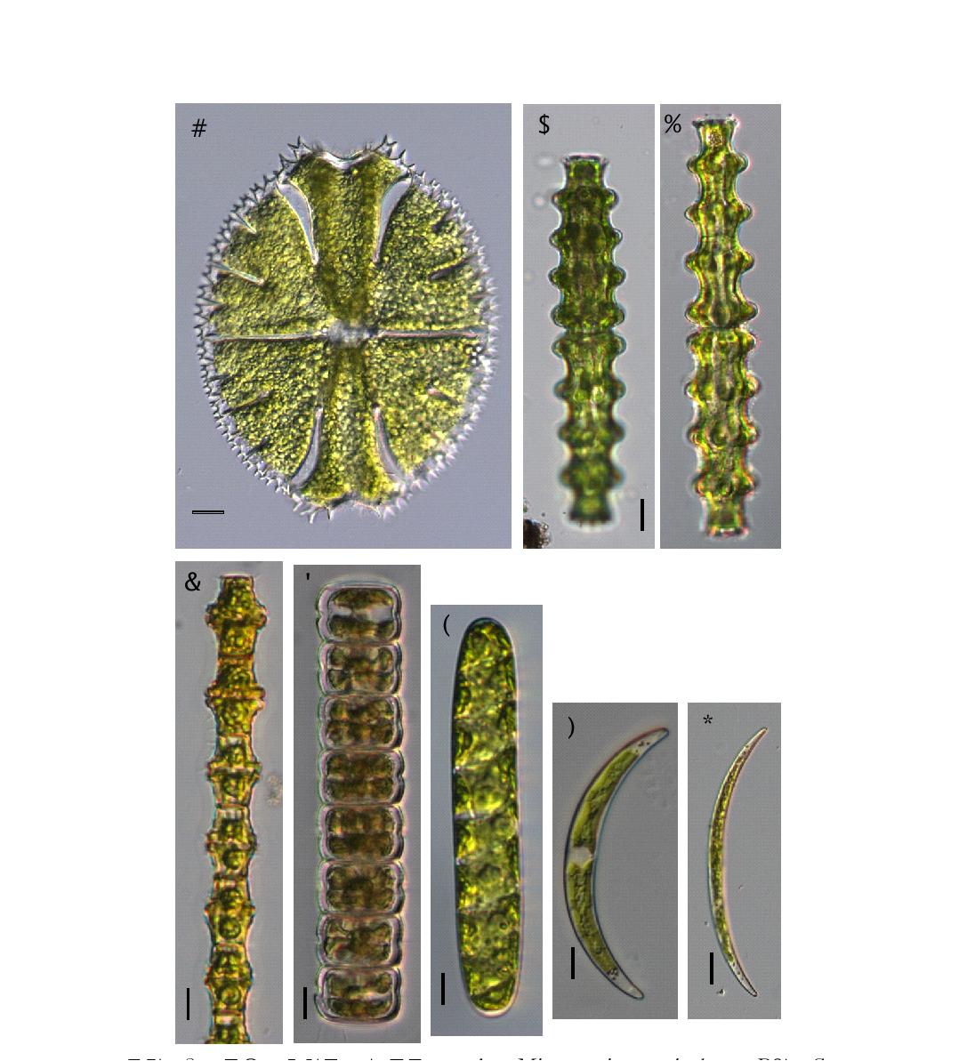 주요 출현종. 녹조류. A. Micrasterias apiculata, B와 C. Pleurotaenium nodosum, D. Bambusina brebissonii, E. Hyalotheca dissiliens, F. Spirotaenia condensata, G. Closterium parvulum, H. Closterium calosporum(Scale bar=10㎛).