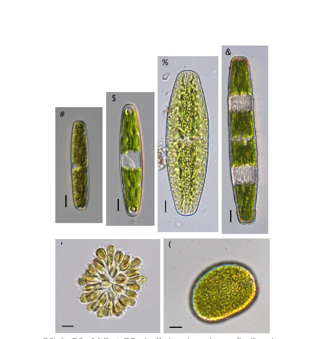 주요 출현종. 녹조류. A. Haplotaenium minutum, B. Closterium closterioides var. intermedium, C. Netrium naegelii, D. Penium spirostriolatum, 편모조류. E. Gonyostomum depressum, F. Synura petersenii(Scale bar=10㎛).