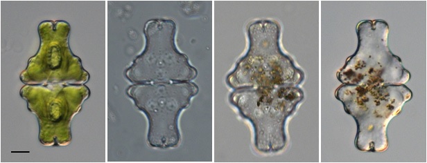 Euastrum sinuosum var. capitatum Scott et Prescott(Scale bar=10 ㎛).