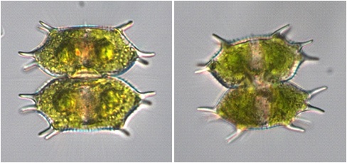 Xanthidium antilopaeum var. planum Roll(Scale bar=10 ㎛).