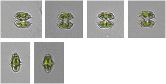 Xanthidium concinnum Roll(Scale bar=10 ㎛).