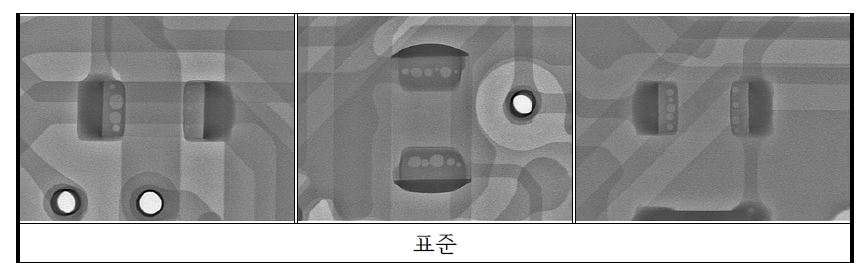 X-Ray 분석 이미지