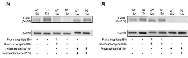 인산화 인식 항체 p-LDB3 (Ser-98) 과 p-LDB3 (Ser-179)의 반응 특이성 분석
