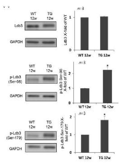 질환 심장 비대 모델 마우스 (JTT TG)에서 LDB3 와 LDB3 특정 인산화 위치의 인산화 수준 분석 결과
