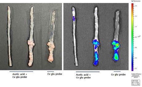 아세트산(acetic acid)을 1.5%를 처리한 정상 쥐의 대장 조직과 암 모델 마우스 대장조직과 처리하지 않은 대장암 조직의 형광 이미지