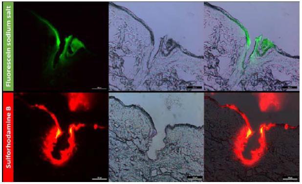 Cryosection images of porcine skin model after applying dye-coated microneedle for 5 min