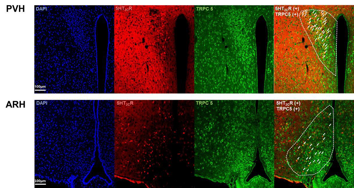 PVH(위)와 ARH(아래)의 Htr2c 발현 뉴런(빨간색)과 TRPC5 발현뉴런(초록색)