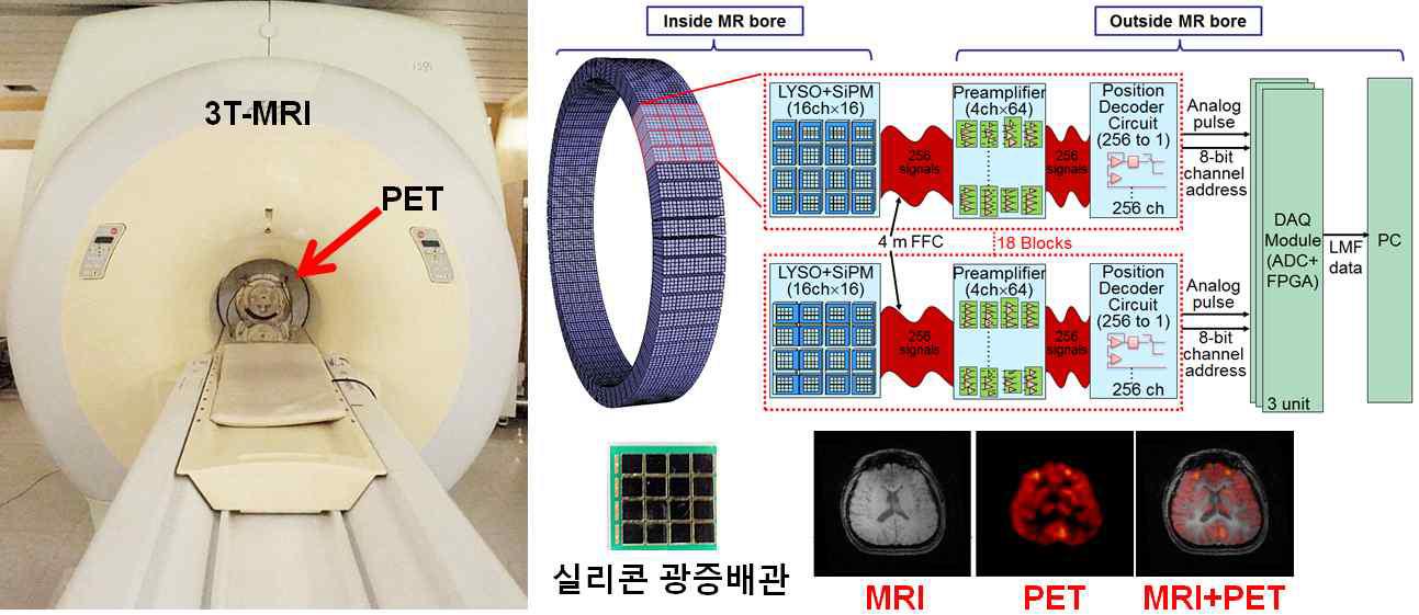 PET-MRI 융합영상기기 개념도