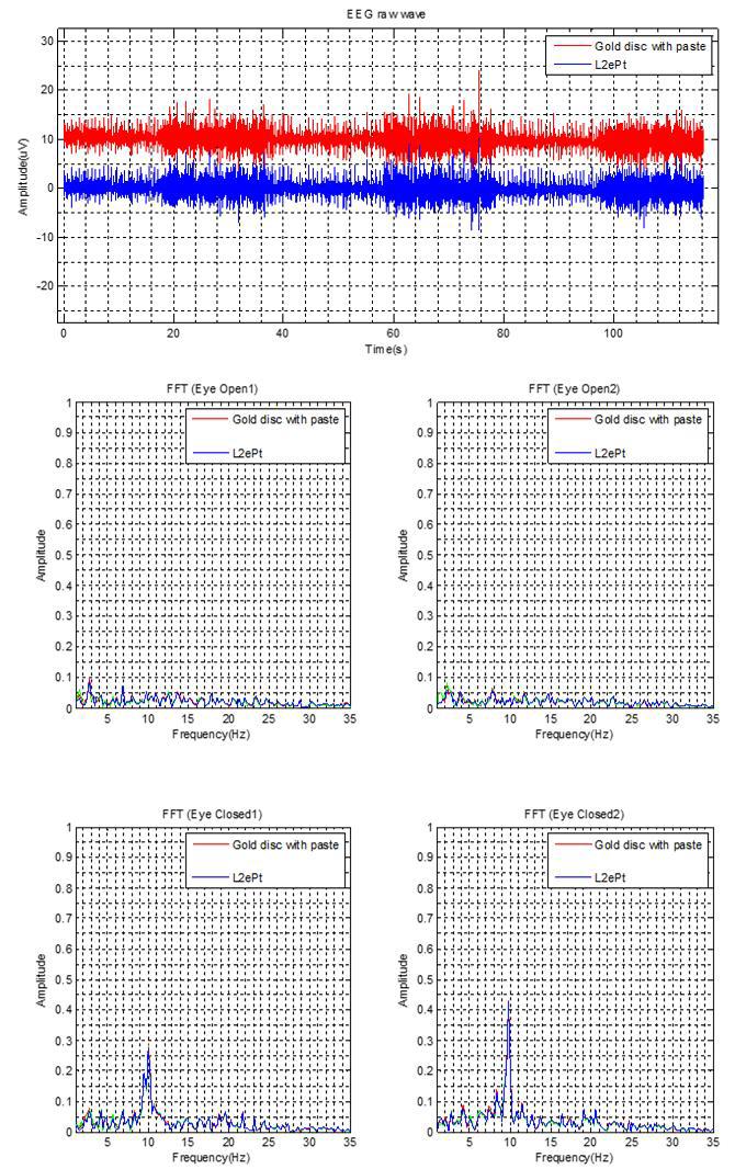 뒤통수에서 L2ePt 전극 (파란색)과 디스크 전극(붉은색)으로 측정한 알파파 (상단 그림). 주파수 대역에서 눈을 뜨고 있을 때는 보이지 않는 알파파 성분 (중단그림). 주파수 대역에서 눈을 감았을 때 나타나는 알파파 (8~13Hz) 반응(하단그림).