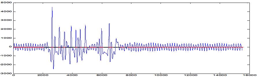 최종 PPG Signal Quality Analysis 알고리즘 결과“Good(빨강)” “Bad(검정)”