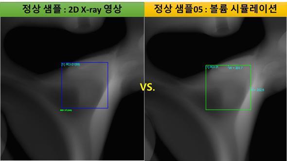 무결함 X-ray 시뮬레이션 영상(우)과 정상 샘플 영상(좌)의 유사도 비교 : NCC 패턴 매칭 유사도 = 0.99