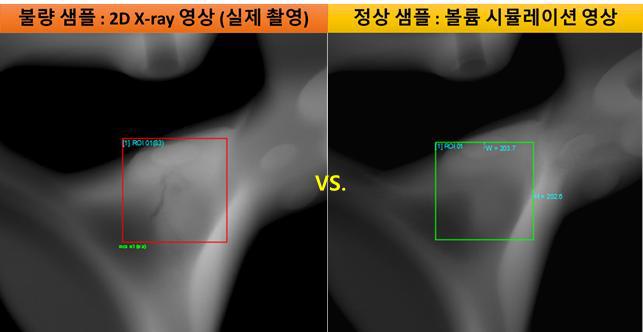 무결함 X-ray 시뮬레이션 영상(우)과 불량 샘플 영상(좌)의 유사도 비교 : NCC 패턴 매칭 유사도 = 0.83