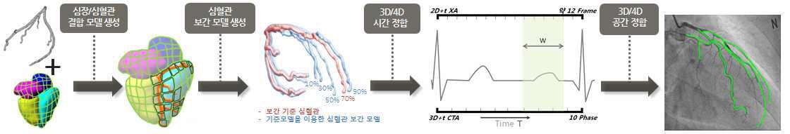 4D 심혈관 보간 모델을 이용한 환자 적응형 정합