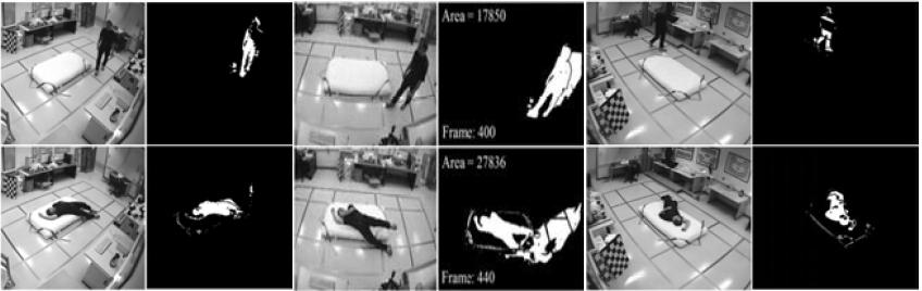 View-invariant fall detection system based on silhouette area and orientation