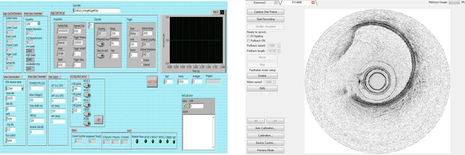 IVUS 및 광음향 모드 동작 제어 GUI