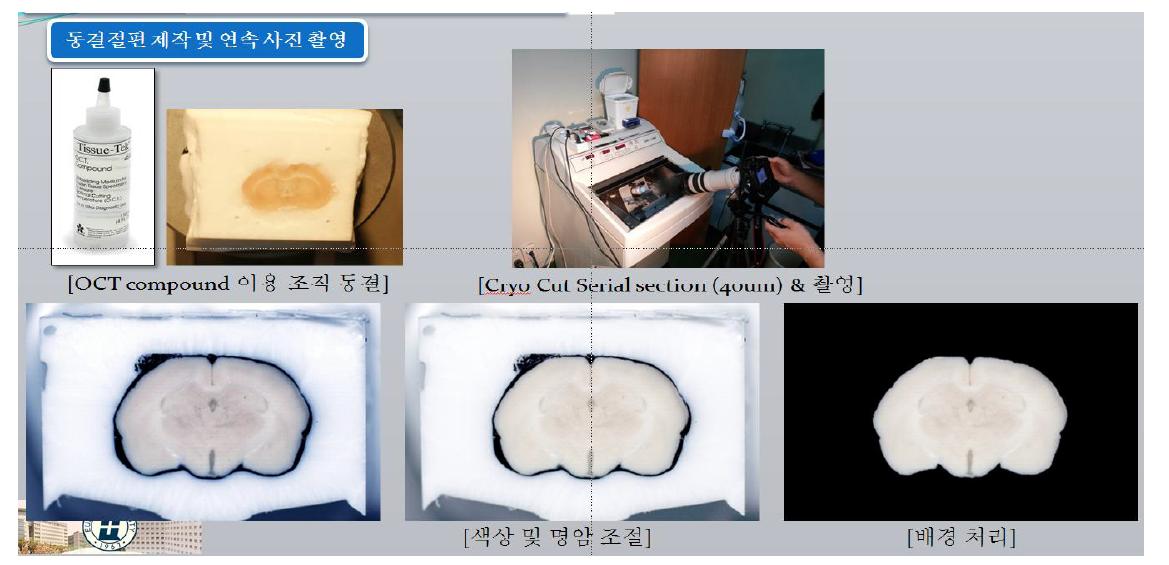 조직 동결법을 이용한 시료의 확보