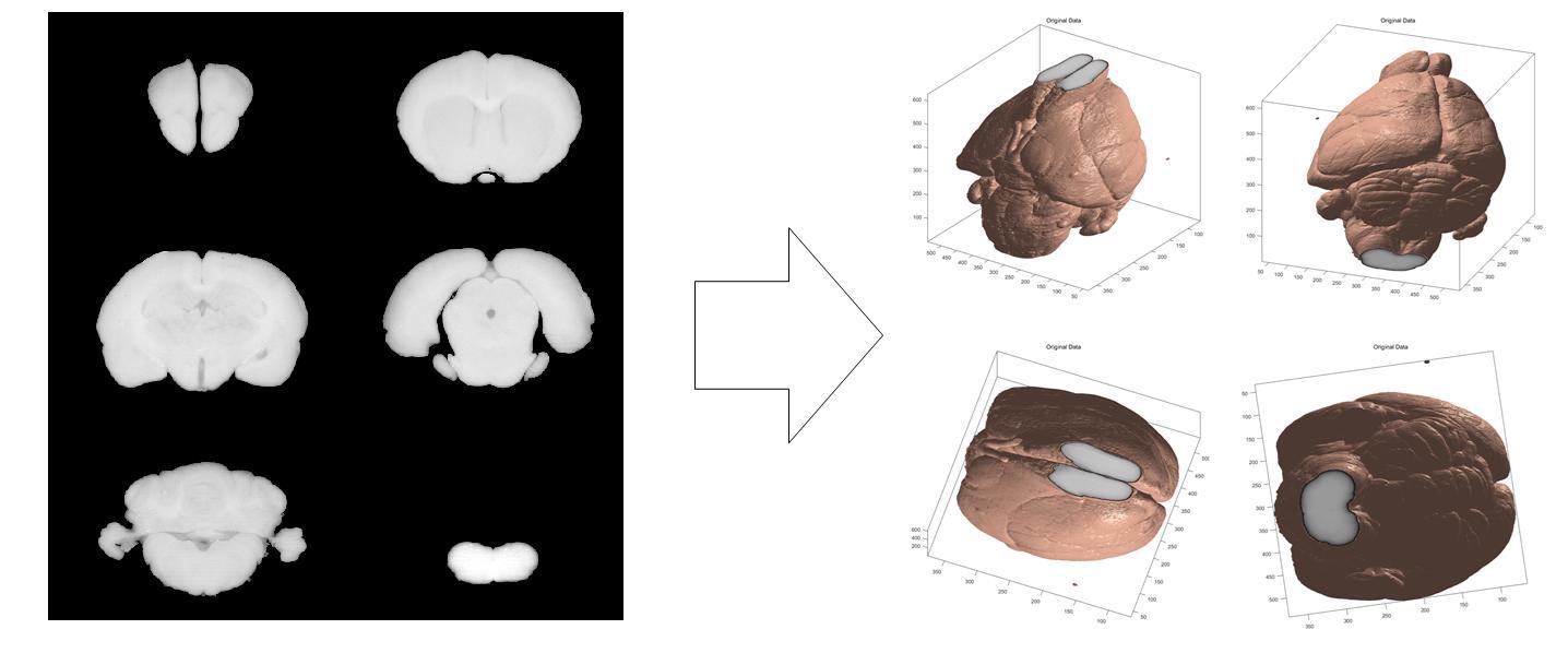 쥐 뇌 절편 입력 영상 (100번째, 200번째, 400번째, 500번째, 600번째 영상)우) 쥐 뇌 절편을 이용한 3차원으로 복원한 쥐 뇌 영상