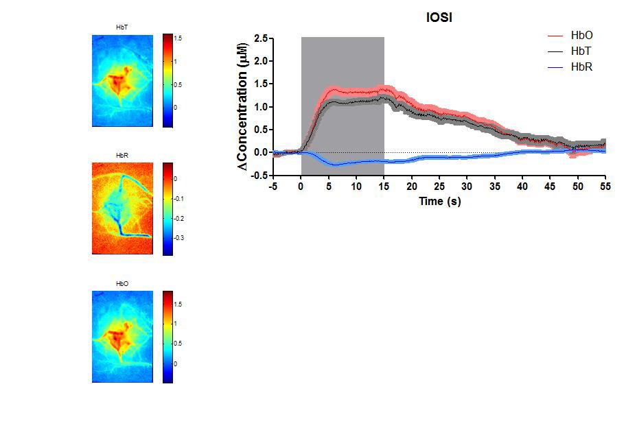 Hemodynamic response region and temporal pattern induced by 15 sec-duration hindpaw electric stimulation